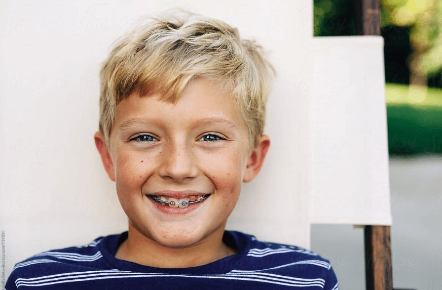 Horton-metal-bracees-boy Metal braces