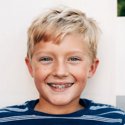 Our thoughts on pushing two-phase orthodontic treatment 3 Young boy smiling with short blonde hair, striped shirt, representing pushing two-phase orthodontic treatment